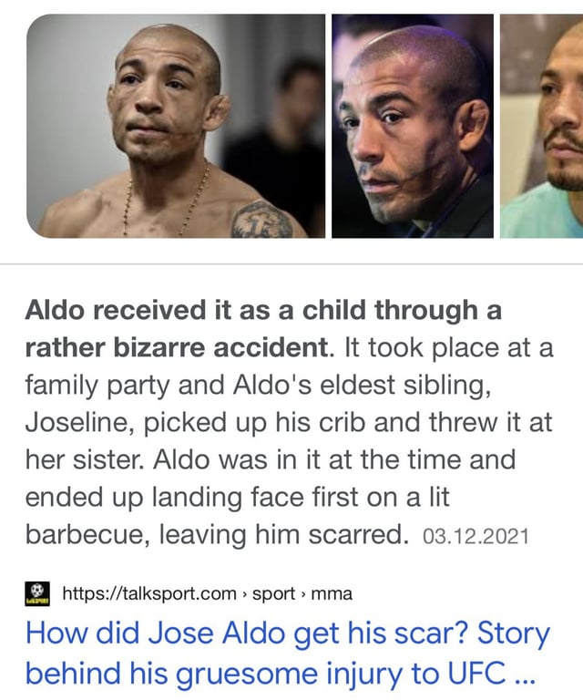 Jose Aldo Scar: The Real Story Behind It - Get the Facts Here