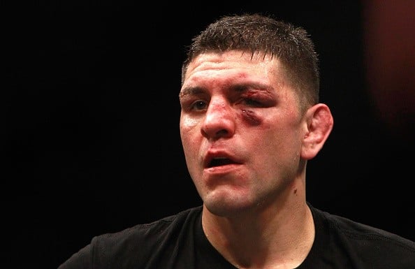 Curious About Nick Diaz Net Worth? Find Out His Earnings and Assets