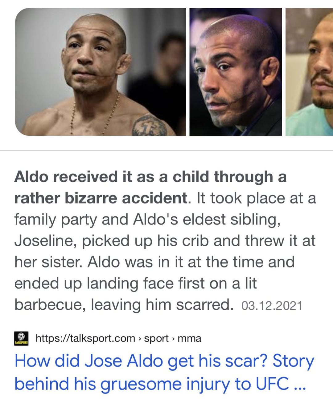 How did Jose Aldo get that scar on his face? The shocking truth!