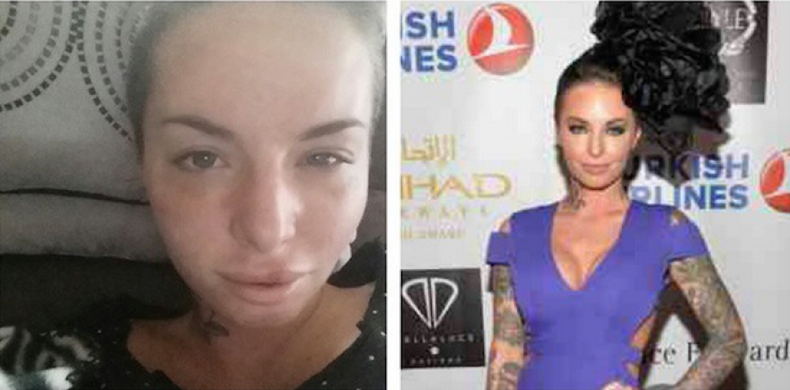 See Christy Mack Before and After: The Real Story!