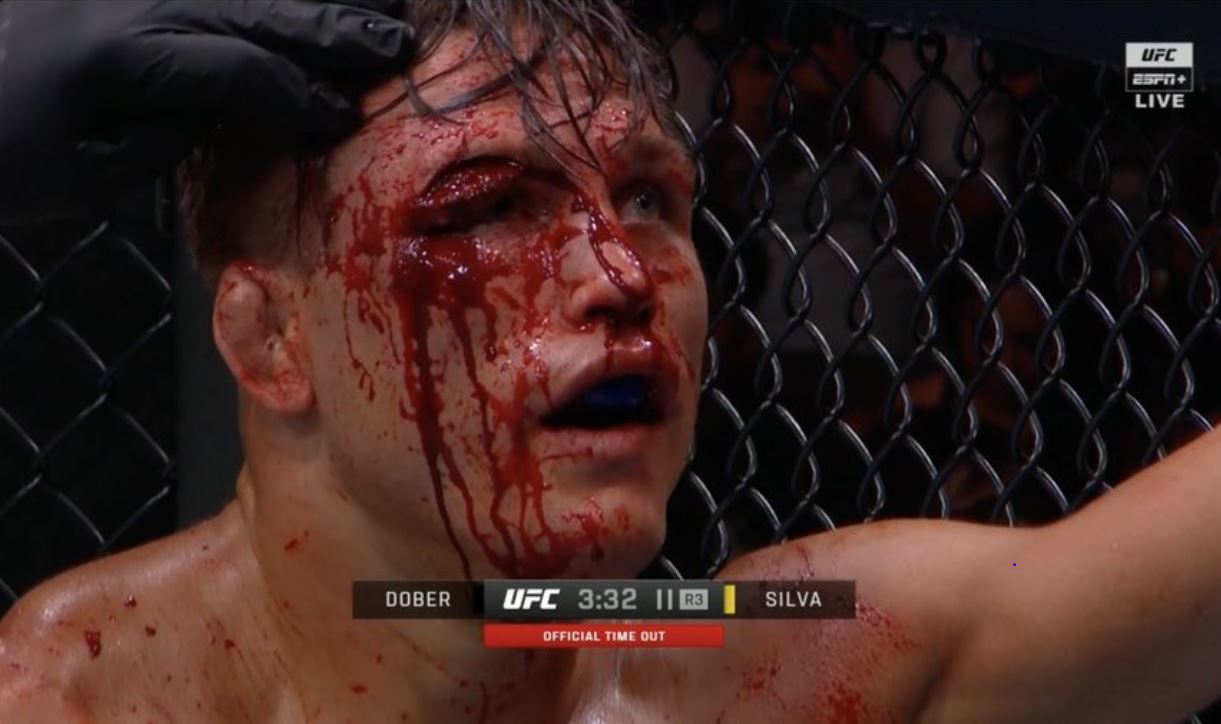 Drew Dober Eye: After the Ankalaev Fight, How is Drew Dobers Eye Now?