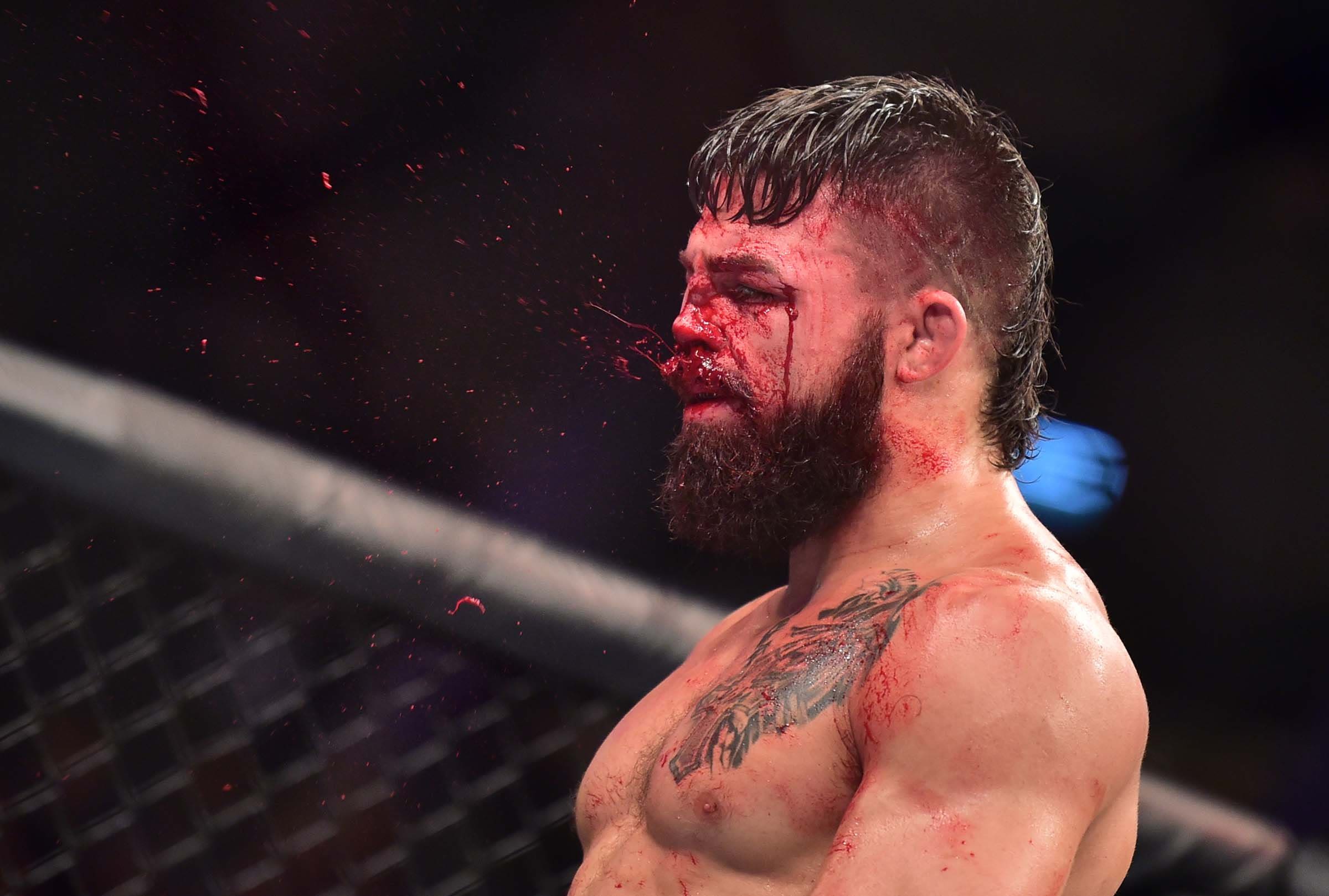 Mike Perry Broken Nose: See How Badly Injured the UFC Fighter Was After His Fight.