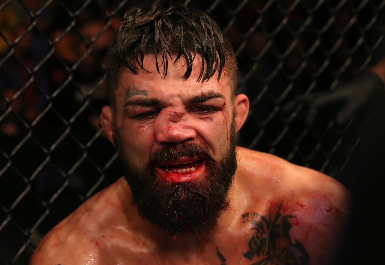 Mike Perry Broken Nose: See How Badly Injured the UFC Fighter Was After His Fight.